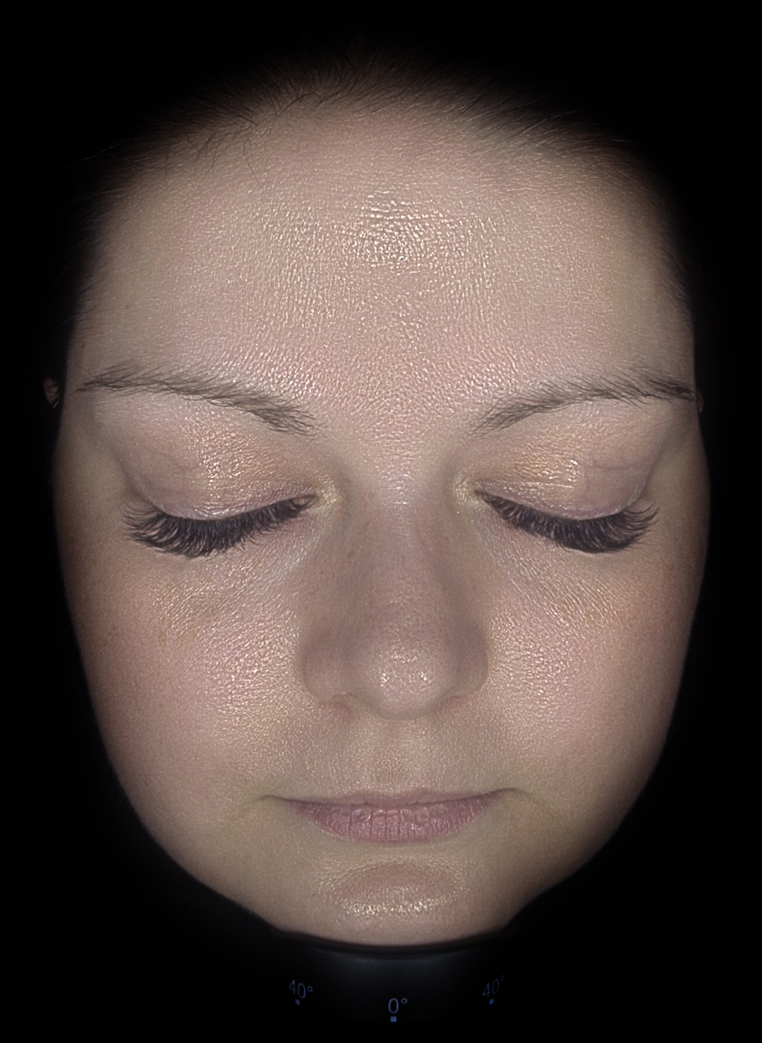 Hautanalyse-Oberflächentextur