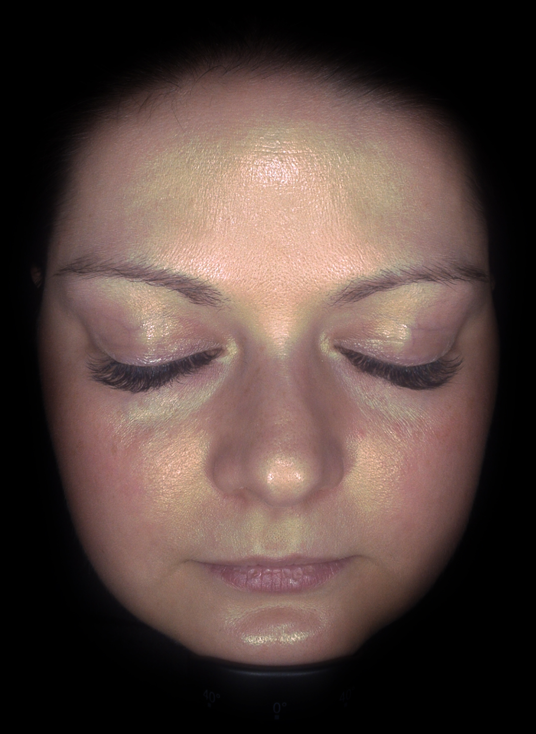 Hautanalyse-Parallel-Polarisiert