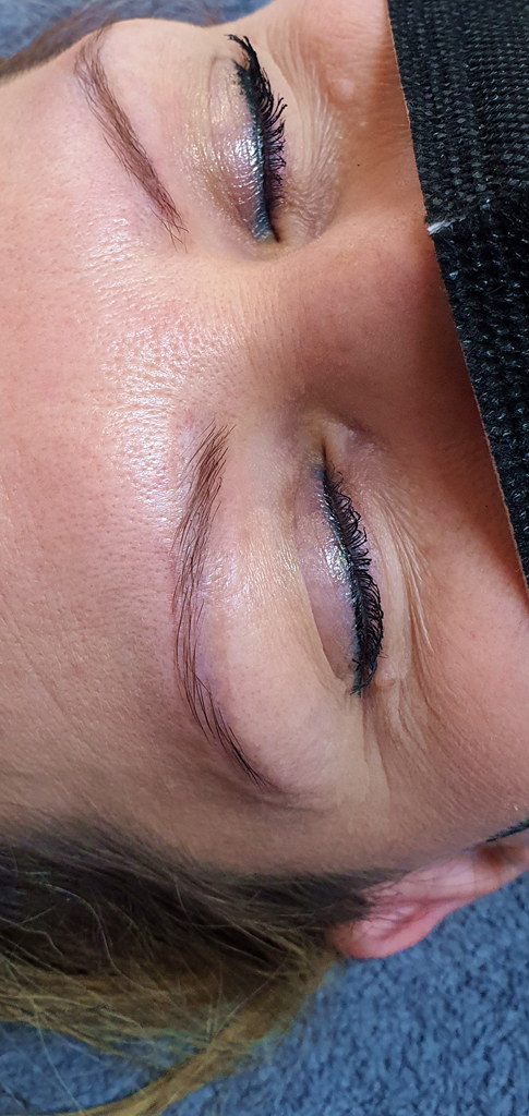Brow Lifting wenig Augenbrauen